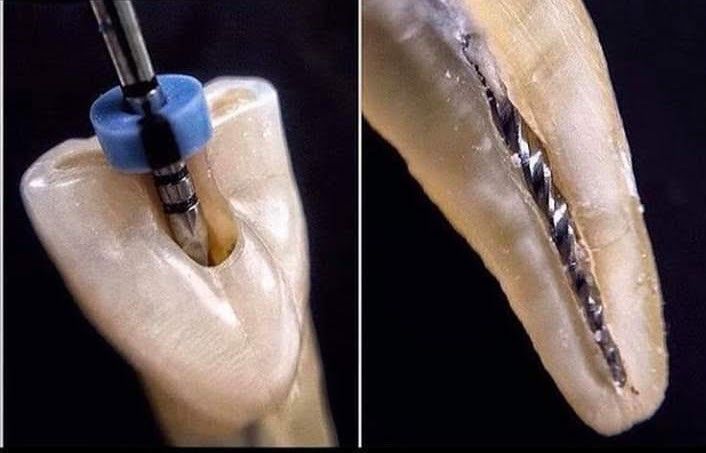 Endodontics